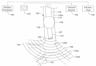 Patent a Pulmonary Biopsy Device