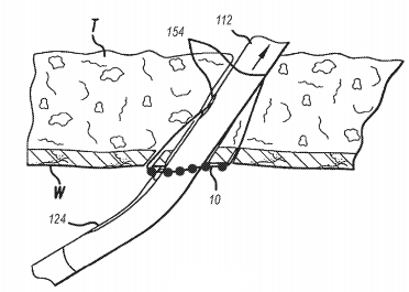 Self-Locking Suture Mediated Closure Device