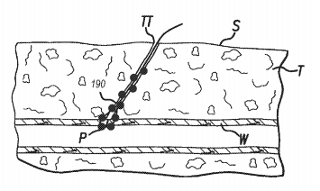 use of self-locking suture mediated closure devices