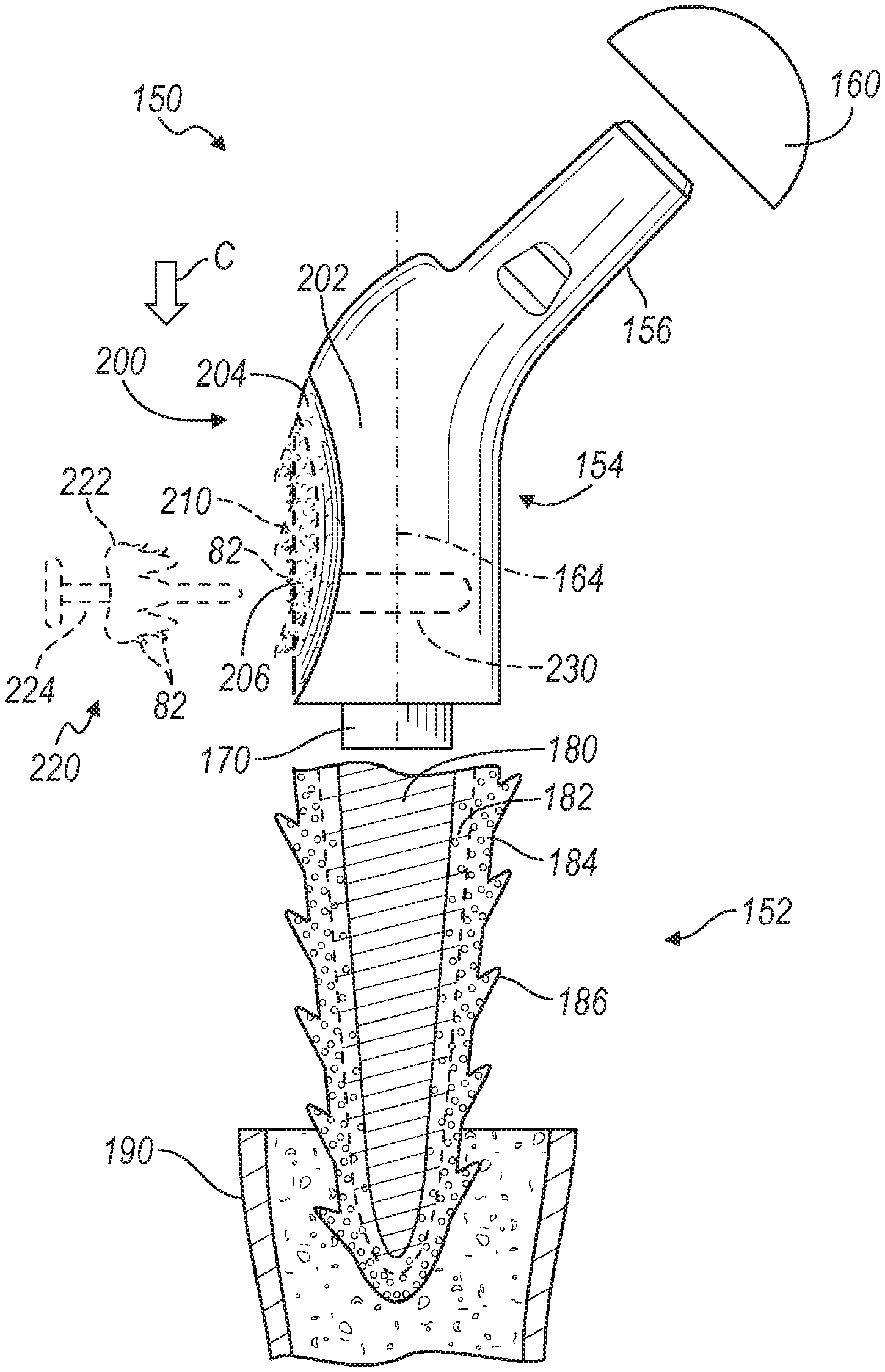 Directional porous coating