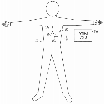 Boston Scientific Files a Patent Application for a Sensor-Based Pain Management System