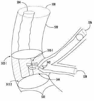 Boston Patent a Body Lumen Imaging System