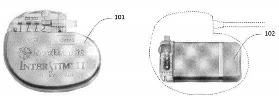 Patent for an Implantable Pulse Generator Carrier to Interface with Multiple Lead Sizes