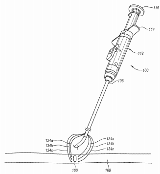 Abbott Patent Devices for Closing Holes in Body Lumens