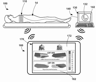 Medtronic Patent a System for Evaluation and Configuration of Cardiac Therapy