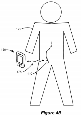 Boston Scientific Seeks to Patent a Filtering Algorithm for Wireless Communication