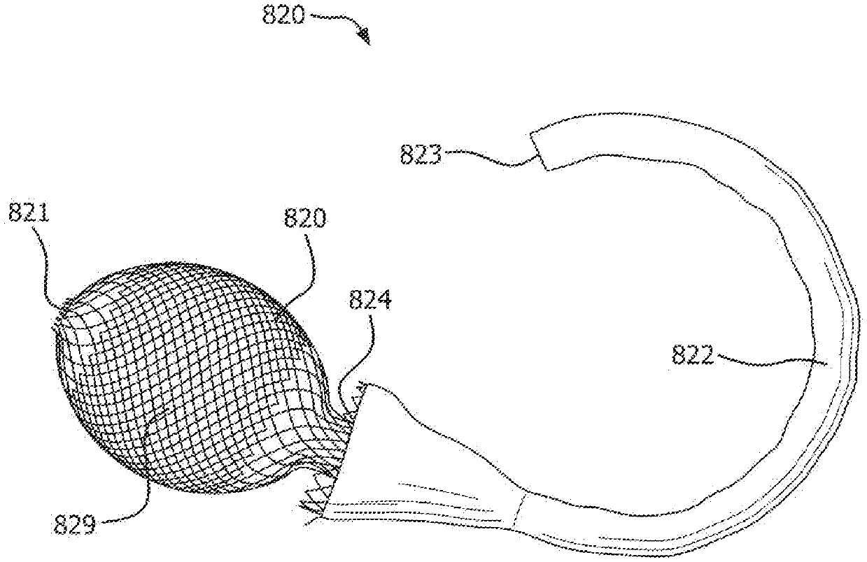 Anchorless intragastric Device For Treating Obesity