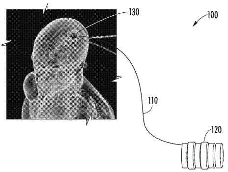 radiotherapy system