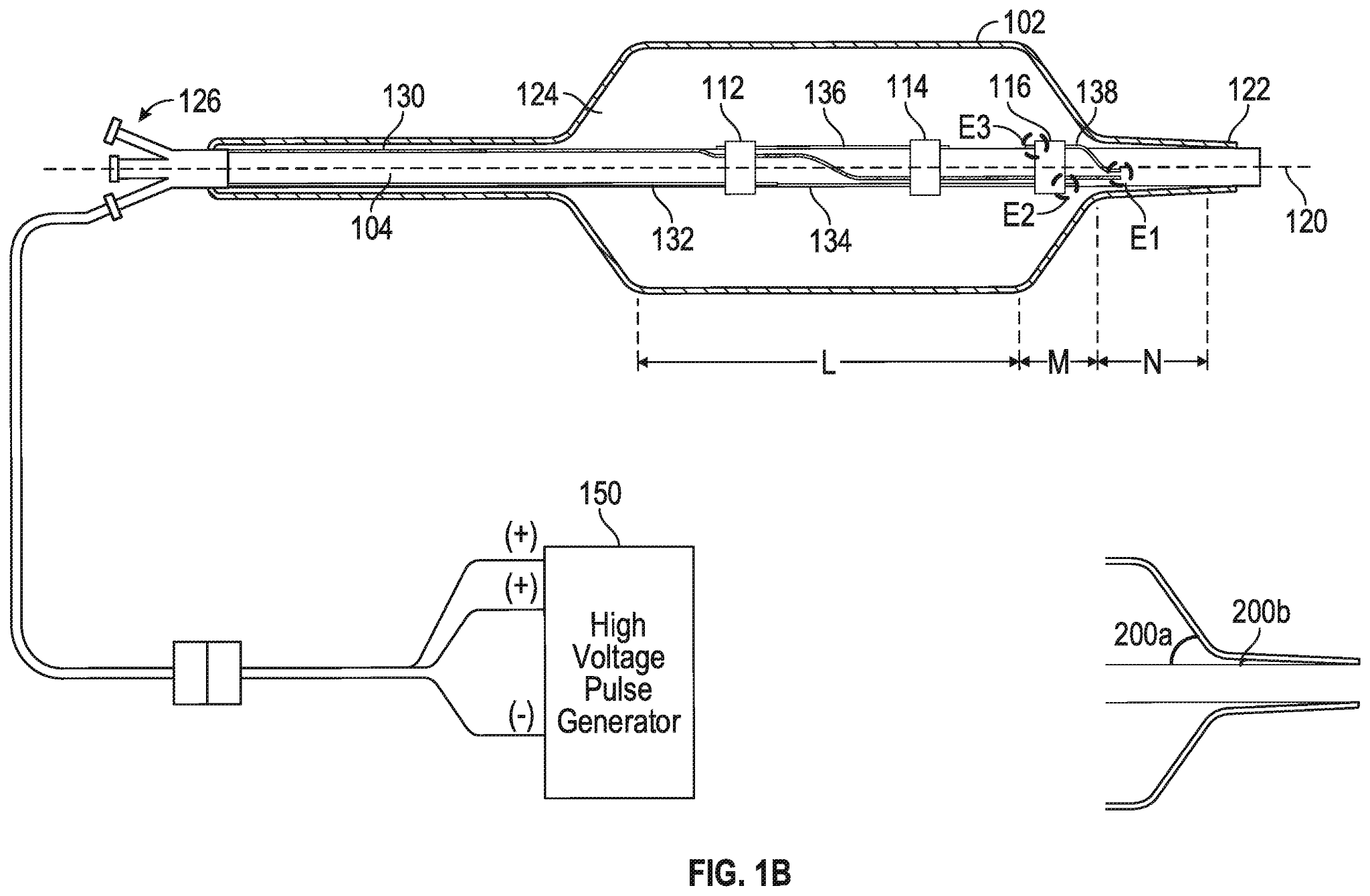 Coronary IVL System