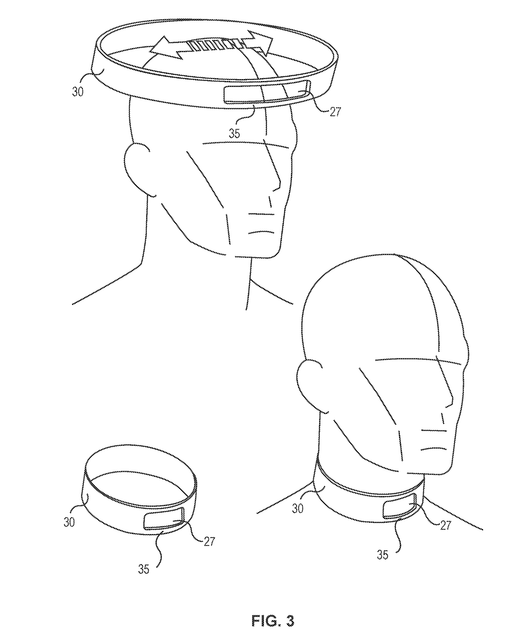 Neurological device Q-collar