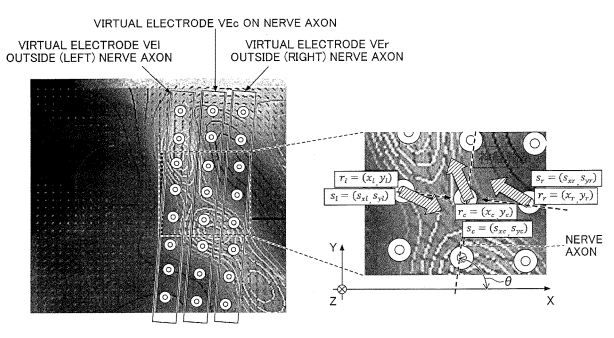 virtual electrodes (VEc)