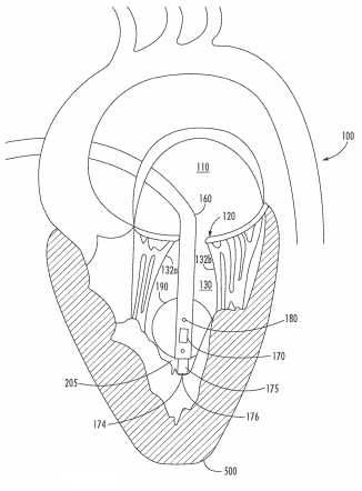 Papillary Approximation Tool with Enhanced Visualization