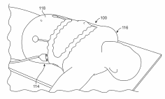 Bioelectric sensor device patient