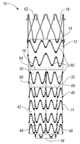 stent-graft device