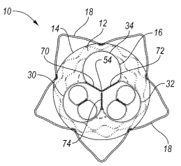 Trifurcated Stent Graft