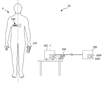 non-invasive patient monitoring system