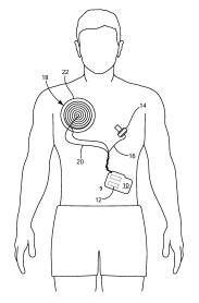 Medtronic Seeks to Patent an Implantable Medical Device Using Graphite to Spread Heat Inside the Device