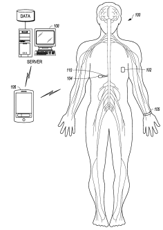 Medtronic Eyes a Patent for Emergency Management Implantable Drug Delivery Systems