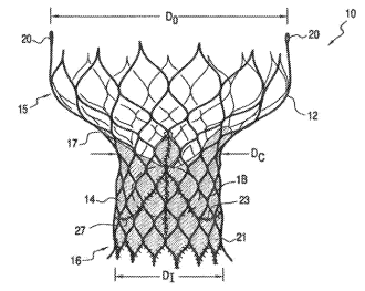 valve prosthesis