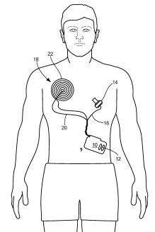 Medtronic Eyes a Patent for an External Wireless Power Transfer Coil