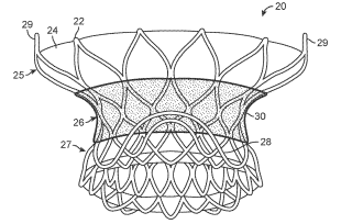 paravalvular leak resistant prosthetic heart valve