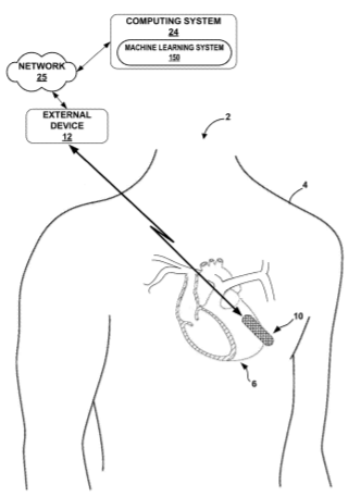 Visualization of Arrhythmia Detection by Machine Learning