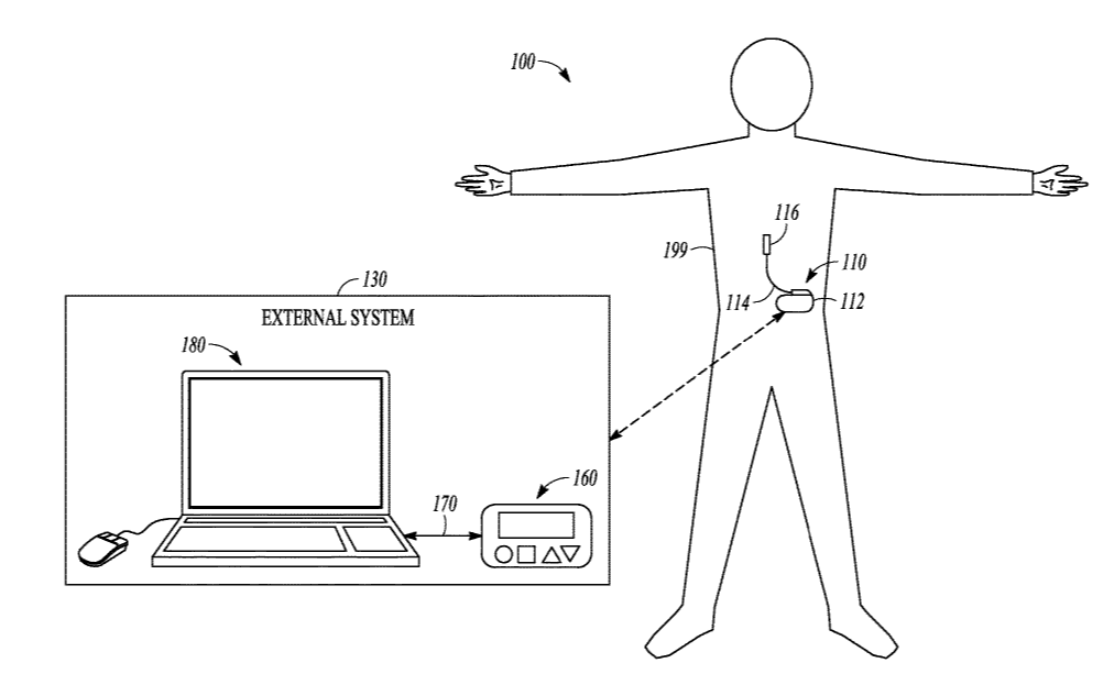 neuromodulation system operates