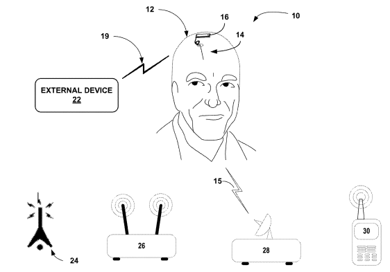 Medtronic Eyes a Patent for an RF Energy Harvesting Antenna