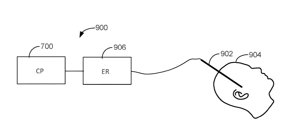 Boston Scientific Files a Patent for Electrical Stimulation Systems Based on Stimulation-Evoked Responses