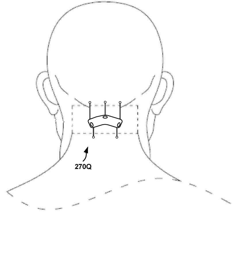 Medtronic Eyes a Patent for a Compact System for Detecting Seizures and Stroke