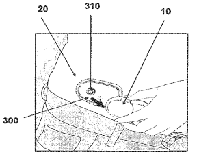 Roche Aims to Patent a System for Sustained Delivery of a Therapeutic Fluid