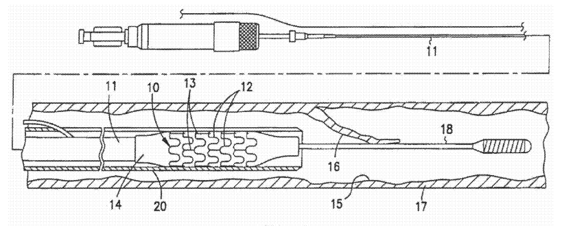 radiopaque stent mounted