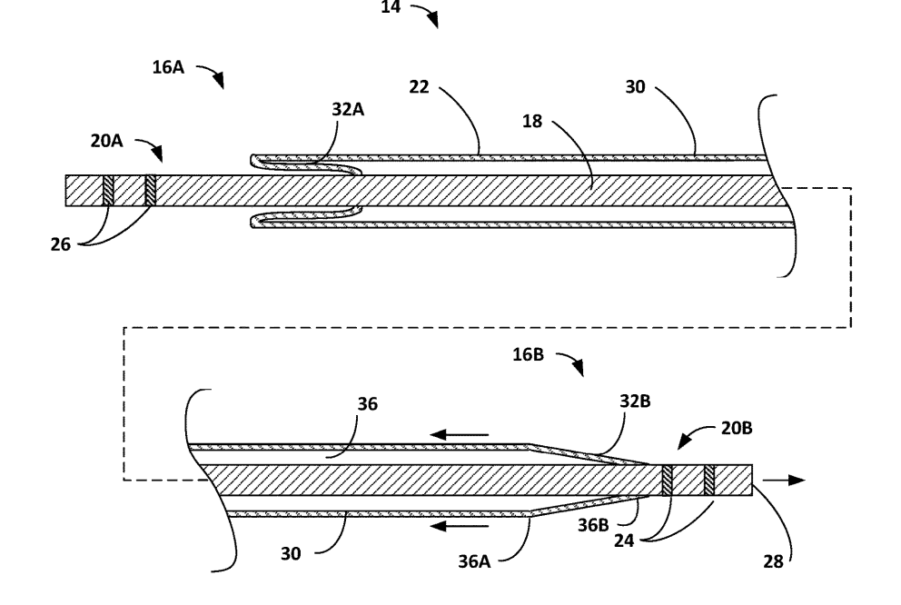 nerve stimulation system