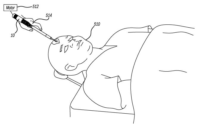 Pressure Loaded Drive Control for Bone Resection