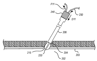 Access Closure Device