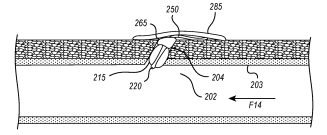 Patent on Access Closure Device