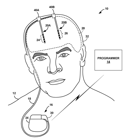 Medtronic Eyes a Patent for a Burr Hole Device Insertion Tool