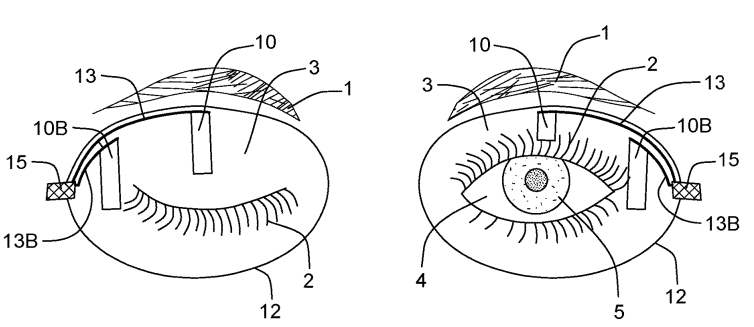 IBM Aims to Patent a Piezoelectric Device for Powering a Smart Contact Lens Using Eyelid Movement