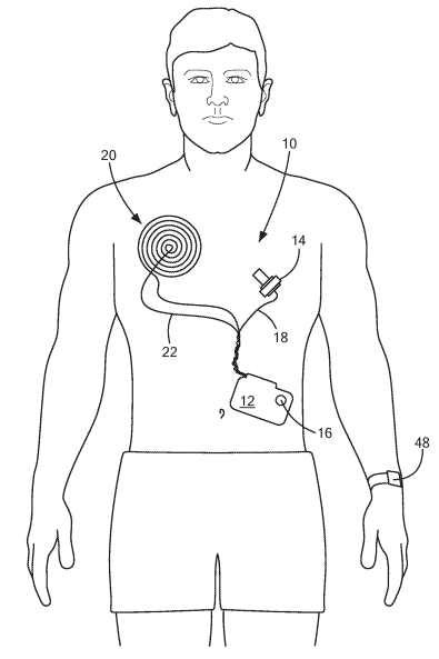 Medtronic Patent for a Temperature Sensing System