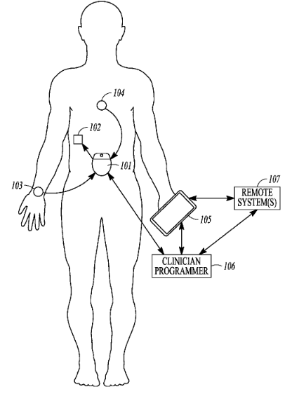 Patent on a Glucose Control Therapy System