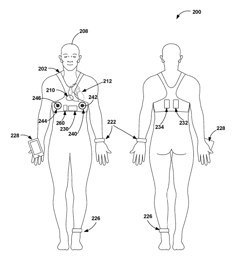 Medtronic Files a Patent for Dry Electrodes in a Wearable Garment