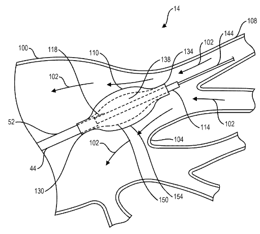 Boston Scientific Files a Patent for a Cryogenic Ablation Control System